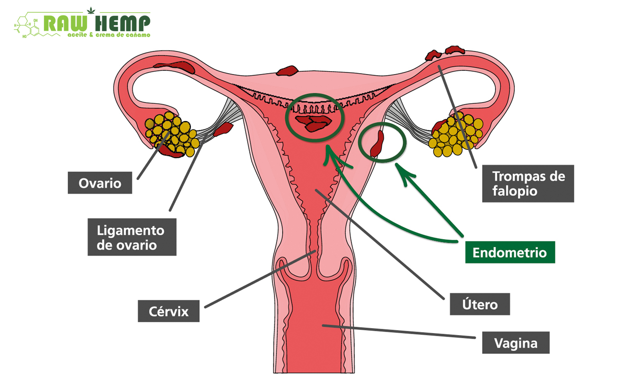 Endometriosis y CBD